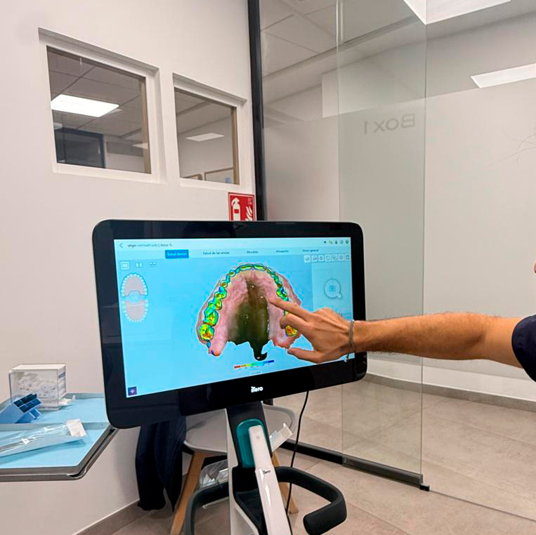 Escaneo digital de la boca para planificar el tratamiento